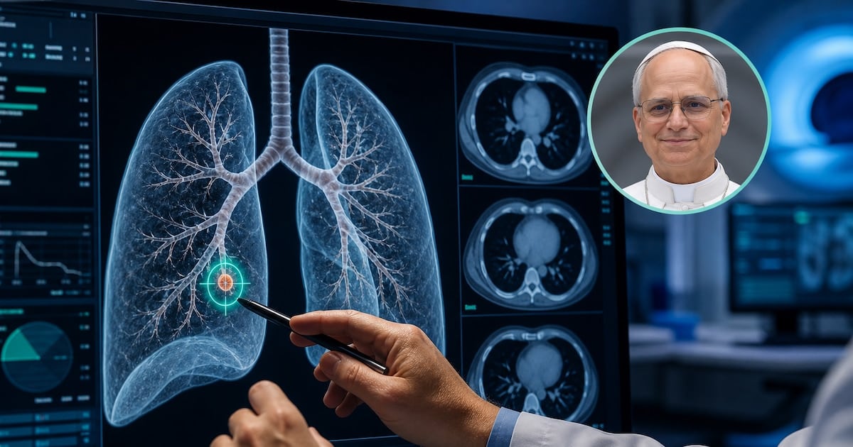 Cuando un nódulo de tres milímetros justifica el bisturí: cómo se decide operar una lesión pulmonar diminuta
